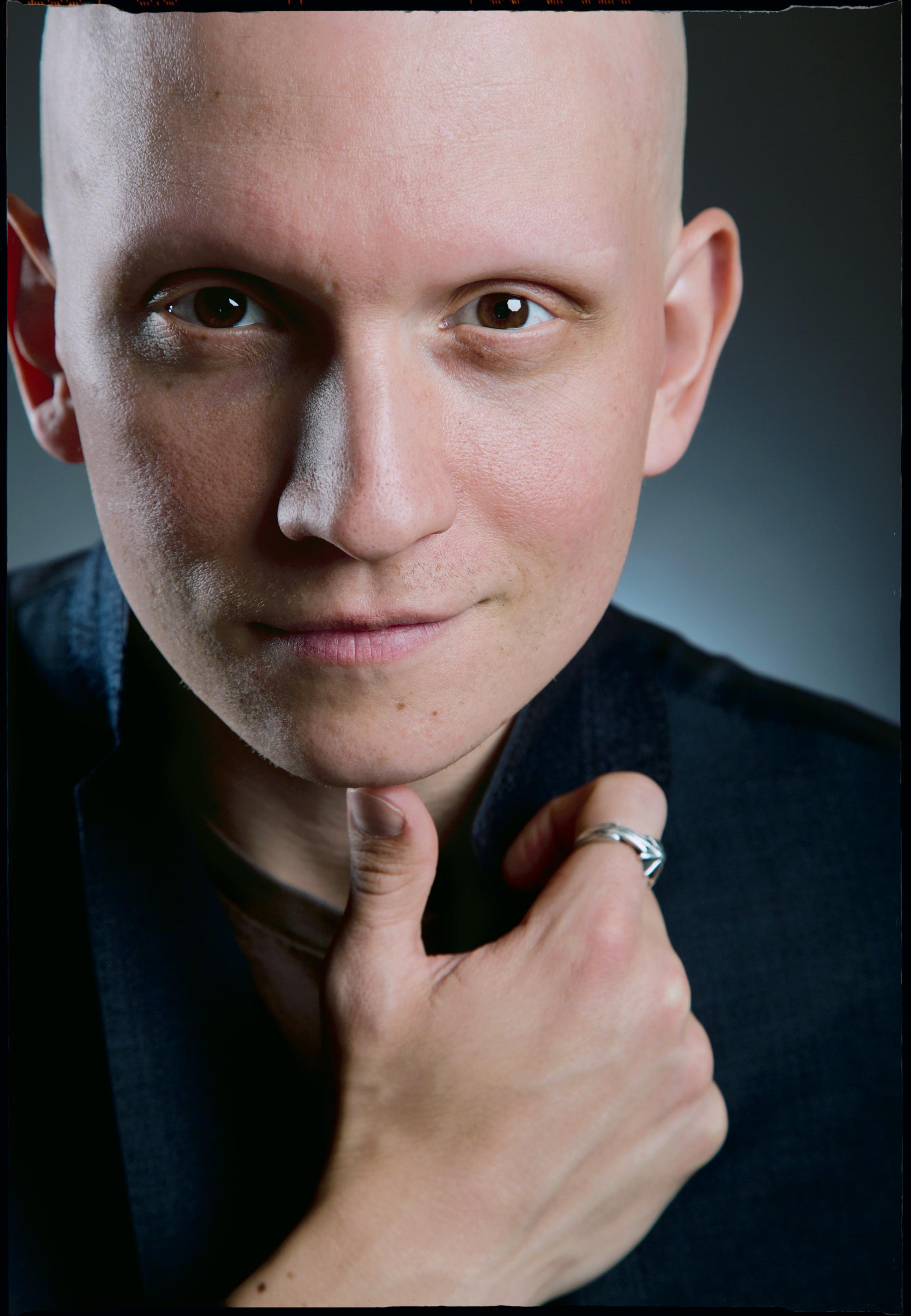 Anthony Carrigan image